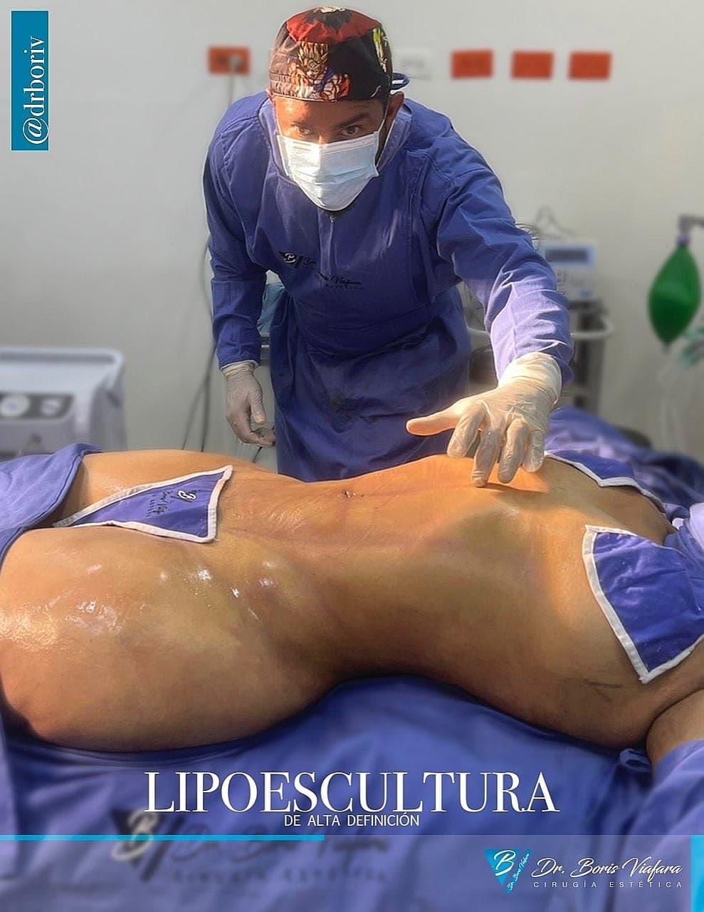 Dr. Boris Viafara en procedimiento de lipoescultura de alta definición